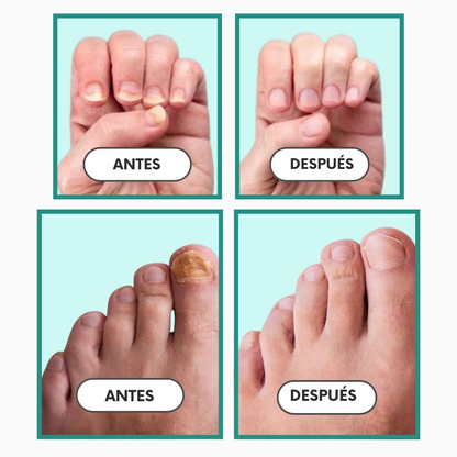 Dispositivo Terapia de Luz Azul OrthoPodo™